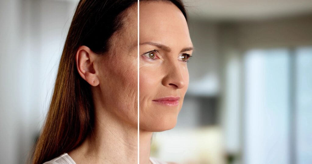 aesthetic results before after wellness