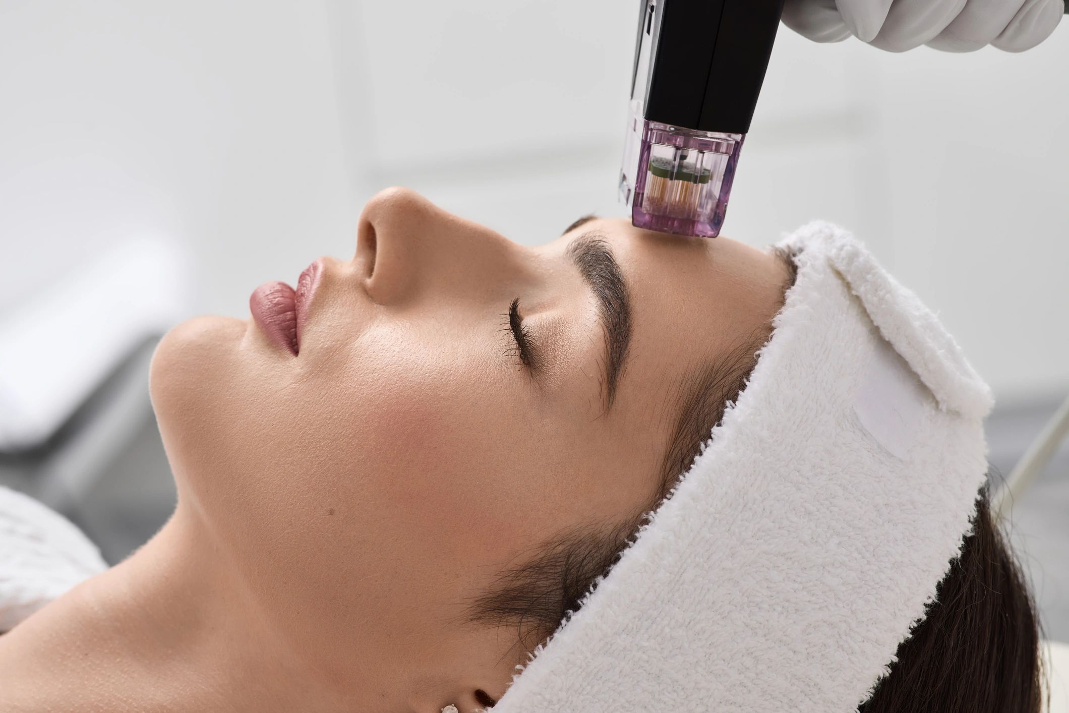 SkinPen microneedling advanced skincare treatment